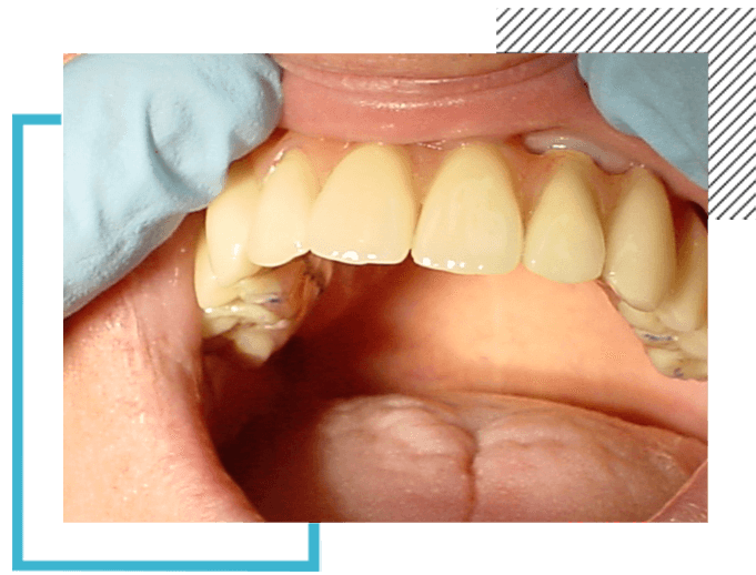 image2-impl-dentist-moulin-gembloux