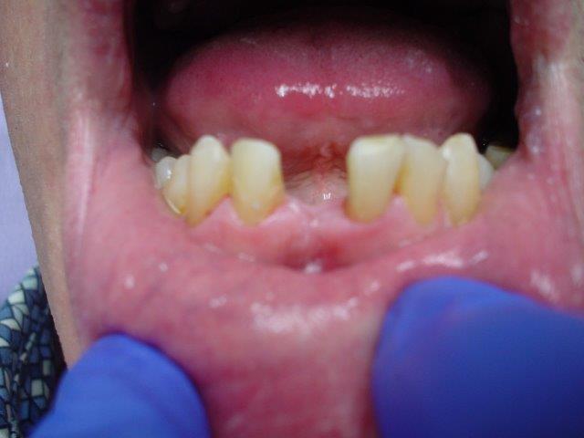autre-soins-dentaires-belgique (2)