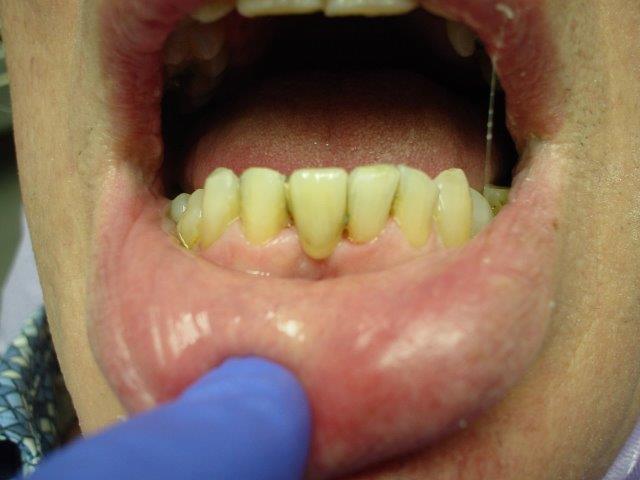 autre-soins-dentaires-belgique (3)