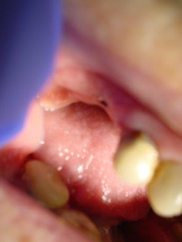 dentiste-bridge-belgique1 (4)