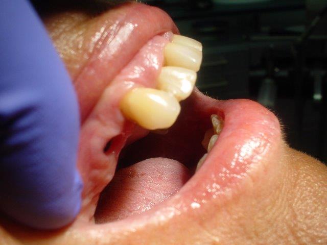 dentiste-bridges-belgique (3)