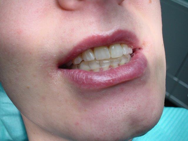 dentiste-gouttiiees-belgique (4)