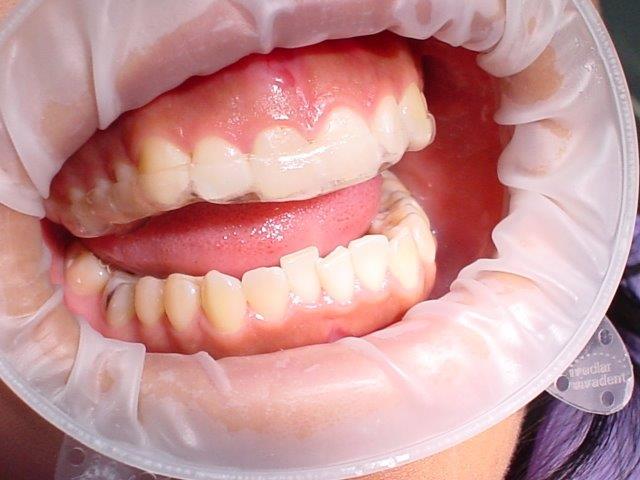 dentiste-gouttiiees-belgique (6)