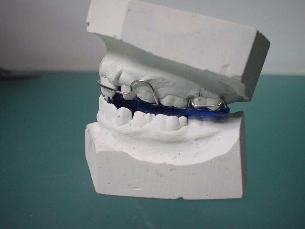 dentiste-orthodontie-belgique (1)