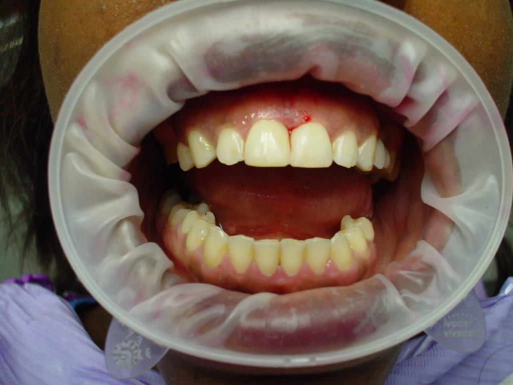 dentiste-soins-esthetique (2)