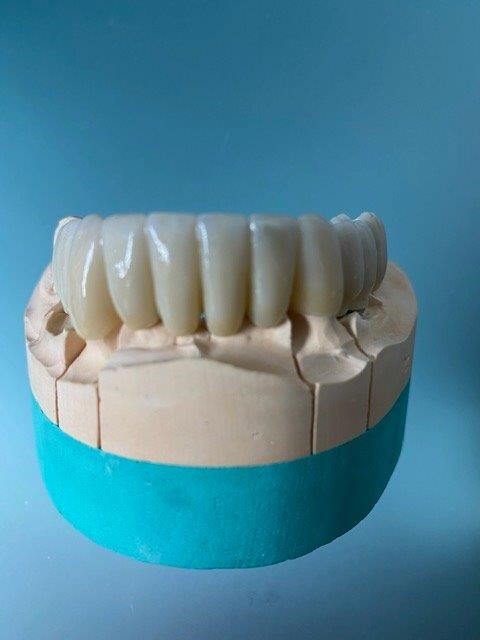 dentiste-hossay-implant-belgique (2)