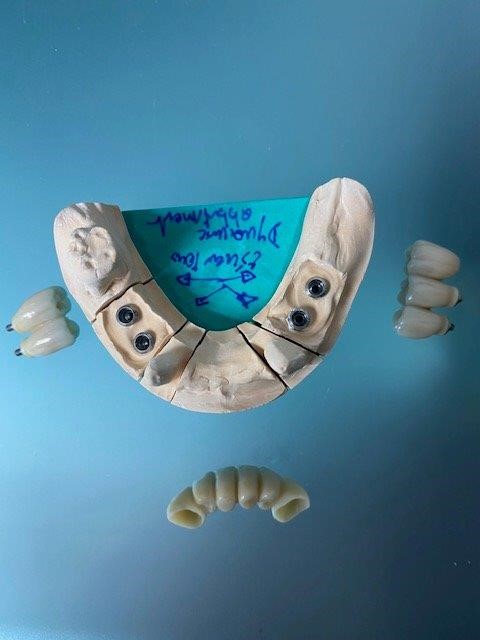 dentiste-hossay-implant-belgique (3)